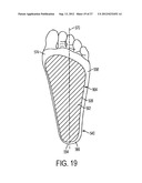 SYSTEM FOR TREATMENT OF PLANTAR FASCIITIS diagram and image