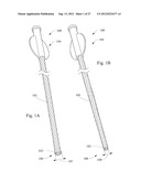 SHORT WIRE CABLE CATHETER diagram and image