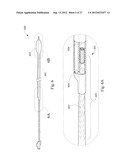 SHORT WIRE CABLE CATHETER diagram and image