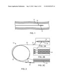 BALLOON CATHETER AND METHOD OF MANUFACTURE diagram and image
