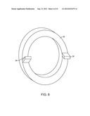 BALLOON CATHETER AND METHOD OF MANUFACTURE diagram and image