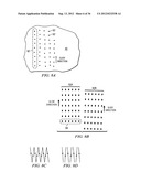 RADIATION-BASED DERMATOLOGICAL DEVICES AND METHODS diagram and image