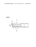 METHOD FOR IMPROVING BLOOD FLOW IN BONE HEAD diagram and image