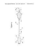 APPARATUS AND METHOD FOR TREATING OCCLUDED VASCULATURE diagram and image