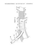 APPARATUS AND METHOD FOR TREATING OCCLUDED VASCULATURE diagram and image