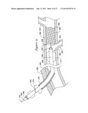 APPARATUS AND METHOD FOR TREATING OCCLUDED VASCULATURE diagram and image