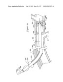 APPARATUS AND METHOD FOR TREATING OCCLUDED VASCULATURE diagram and image