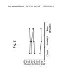 Systems and Methods for Electrically Stimulating the Lower Esophageal     Sphincter to Treat Gastroesophageal Reflux Disease diagram and image