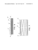 STENT/GRAFT DEVICE FOR OPEN SURGICAL PLACEMENT diagram and image