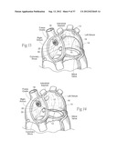 DEVICES, SYSTEMS, AND METHODS FOR RESHAPING A HEART VALVE ANNULUS,     INCLUDING THE USE OF MAGNETIC TOOLS diagram and image