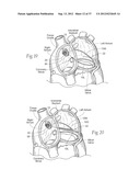 DEVICES, SYSTEMS, AND METHODS FOR RESHAPING A HEART VALVE ANNULUS,     INCLUDING THE USE OF MAGNETIC TOOLS diagram and image