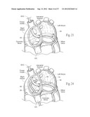 DEVICES, SYSTEMS, AND METHODS FOR RESHAPING A HEART VALVE ANNULUS,     INCLUDING THE USE OF MAGNETIC TOOLS diagram and image