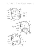 DEVICES, SYSTEMS, AND METHODS FOR RESHAPING A HEART VALVE ANNULUS,     INCLUDING THE USE OF MAGNETIC TOOLS diagram and image