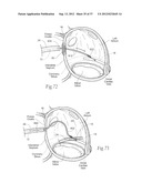 DEVICES, SYSTEMS, AND METHODS FOR RESHAPING A HEART VALVE ANNULUS,     INCLUDING THE USE OF MAGNETIC TOOLS diagram and image