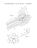 DEVICES, SYSTEMS, AND METHODS FOR RESHAPING A HEART VALVE ANNULUS,     INCLUDING THE USE OF MAGNETIC TOOLS diagram and image