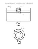 IMPLANTATION OF SHAPE MEMORY POLYMER INTRAOCULAR DEVICES diagram and image