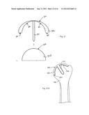 HUMERAL JOINT REPLACEMENT COMPONENT diagram and image