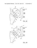 SHOULDER PROSTHETIC diagram and image