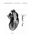 PHYSICALLY-CONSTRAINED MODELING OF A HEART IN MEDICAL IMAGING diagram and image