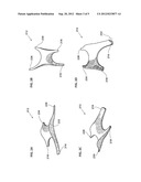 HIGH-STABILITY MULTI-DENSITY MIDSOLE diagram and image