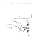 AEROSOLISATION SYSTEM diagram and image