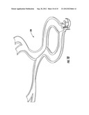 APPARATUS AND METHODS FOR WATER TREATMENT diagram and image