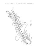 SURGICAL FASTENER INSTRUMENTS diagram and image