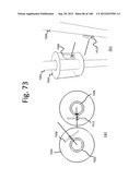 SECURE WIRELESS ENERGY TRANSFER IN MEDICAL APPLICATIONS diagram and image