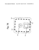 SECURE WIRELESS ENERGY TRANSFER IN MEDICAL APPLICATIONS diagram and image