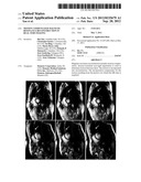 MOTION COMPENSATED MAGNETIC RESONANCE RECONSTRUCTION IN REAL-TIME IMAGING diagram and image