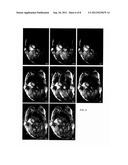 MOTION COMPENSATED MAGNETIC RESONANCE RECONSTRUCTION IN REAL-TIME IMAGING diagram and image