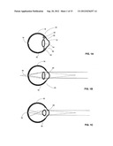 Vision Modification with reflected image diagram and image