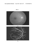 AUTOMATED DETERMINATION OF ARTERIOVENOUS RATIO IN IMAGES OF BLOOD VESSELS diagram and image