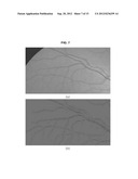 AUTOMATED DETERMINATION OF ARTERIOVENOUS RATIO IN IMAGES OF BLOOD VESSELS diagram and image