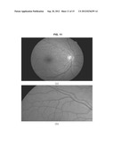 AUTOMATED DETERMINATION OF ARTERIOVENOUS RATIO IN IMAGES OF BLOOD VESSELS diagram and image