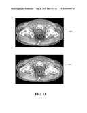 METHODS OF SCATTER CORRECTION OF X-RAY PROJECTION DATA 1 diagram and image