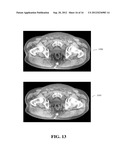 METHODS OF SCATTER CORRECTION OF X-RAY PROJECTION DATA 2 diagram and image