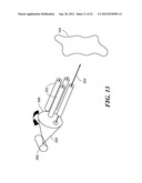 X-Ray Inspection Based on Concealed Transmission Detection diagram and image