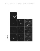 Generation of Functional Basal Forebrain Cholinergic Neurons From Stem     Cells diagram and image