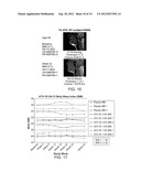 TREATMENT OF SUBMENTAL FAT diagram and image