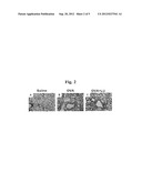 NOVEL USE OF L. UNDULATA EXTRACT AS THERAPEUTICS FOR ALLERGIC DISEASES diagram and image