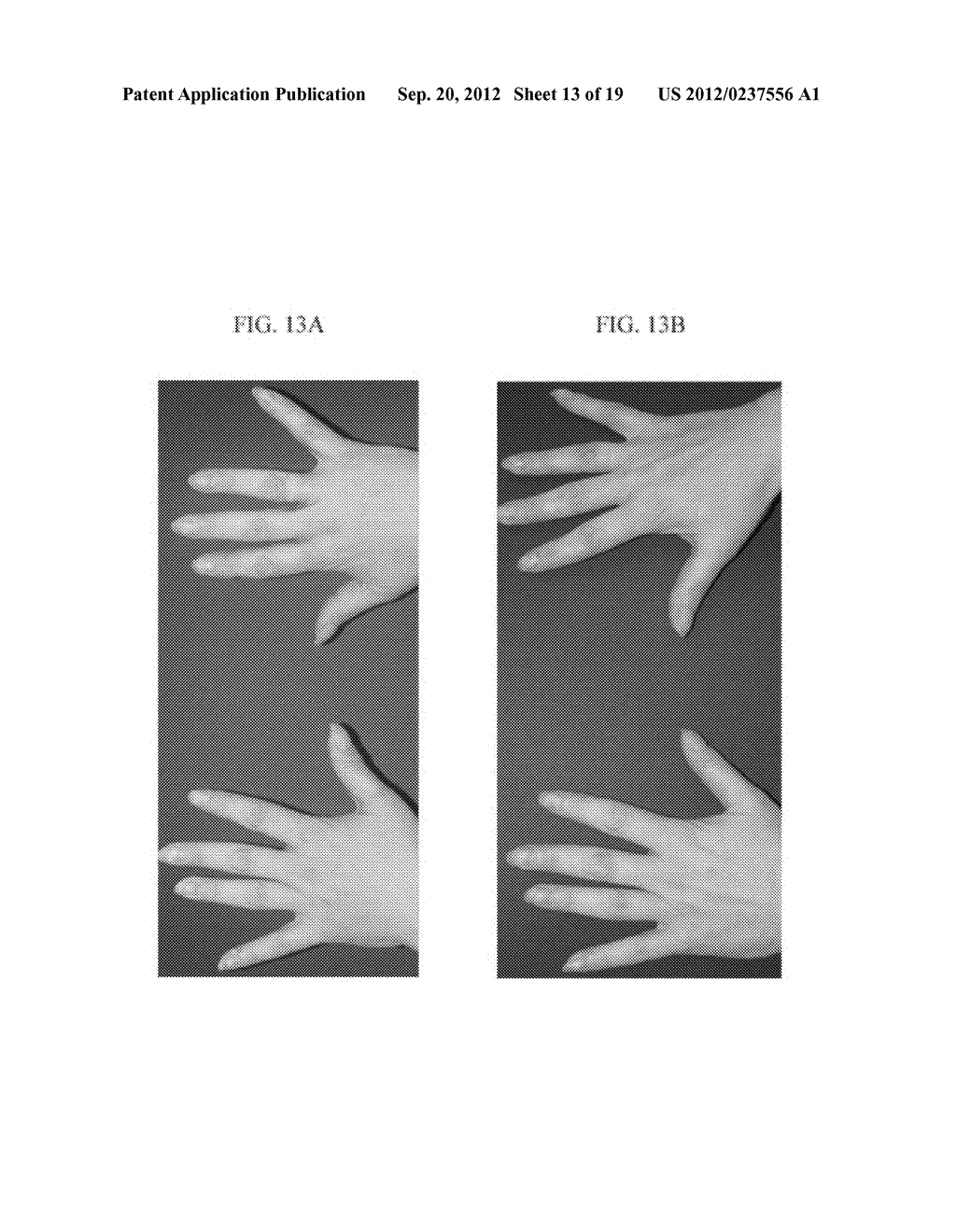 TOPICAL BASE AND ACTIVE AGENT-CONTAINING COMPOSITIONS, AND METHODS FOR     IMPROVING AND TREATING SKIN - diagram, schematic, and image 14