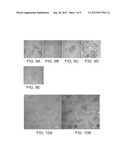 ANTIBIOTIC DRUG DELIVERY AND POTENTIATION diagram and image