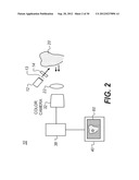 APPARATUS FOR CARIES DETECTION diagram and image