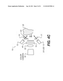 APPARATUS FOR CARIES DETECTION diagram and image