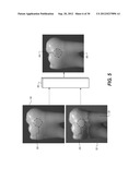 APPARATUS FOR CARIES DETECTION diagram and image