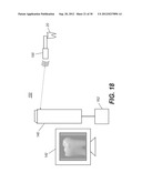 APPARATUS FOR CARIES DETECTION diagram and image