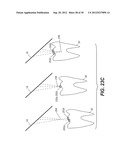 APPARATUS FOR CARIES DETECTION diagram and image
