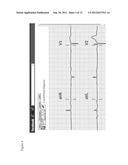 12-LEAD ELECTROCARDIOGRAM ONLINE-LEARNING SYSTEM diagram and image