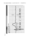 12-LEAD ELECTROCARDIOGRAM ONLINE-LEARNING SYSTEM diagram and image